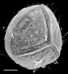 Isoetes alpina. SEM proximal view of macrospore showing trilete markings and smooth surface. From photos by D.M. Britton attached to WELT P003757. Scale bar = 100 μm.
 Image: J.C. Stahl © Te Papa CC BY-NC 3.0 NZ